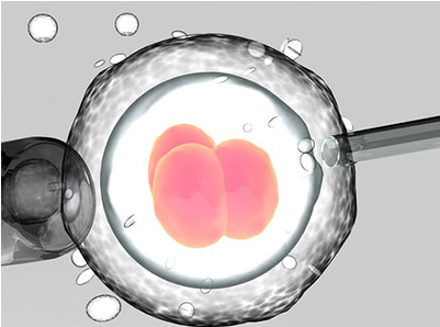 案例